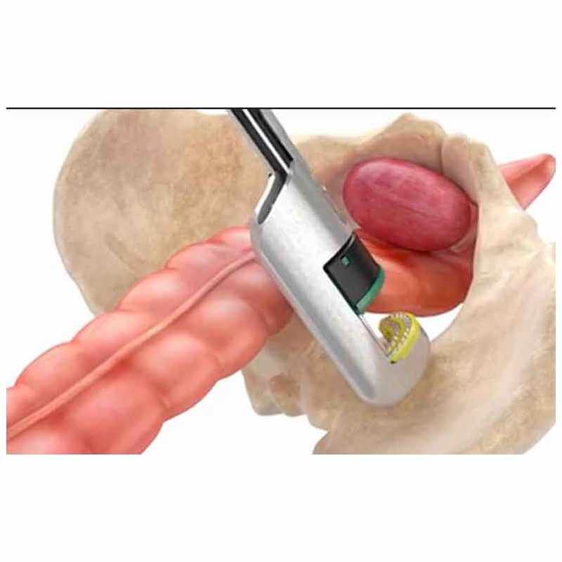 Surgical Suture Stapler Biomedica Tunisia