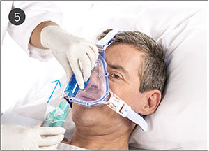 Guide d'ajustement des masques AcuCare