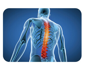 Prevention of musculoskeletal disorders